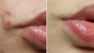 How To Cover Spots With Makeup In 5 Easy Steps [upl. by Whorton730]