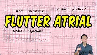 Eletrocardiograma  análise  flutter atrial [upl. by Bowerman]