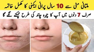 Multani Mitti Face Pack For Every Skin Type How to Remove Acne And Pigmentation [upl. by Marder859]