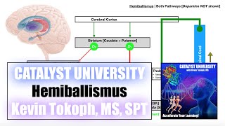 Hemiballismus  Pathogenesis SignsSymptoms and Detailed Mechanism [upl. by Ardme]