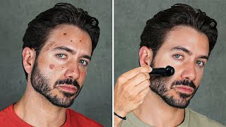 how to get clear skin for guys asap [upl. by Neyrb]