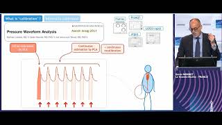 Should we go calibrated or uncalibrated Xavier Monnet 2022 [upl. by Aifas]