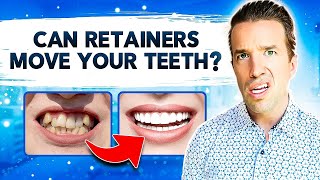 Can Retainers Move Your Teeth  Retainers [upl. by Ephrem]