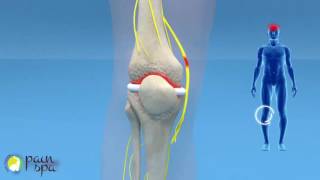 COOLIEF Genicular nerve block and radiofrequency of the Knee Joint [upl. by Caswell]