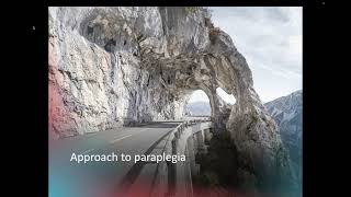 Approach to paraplegia and localizing spinal levels [upl. by Hagerman120]