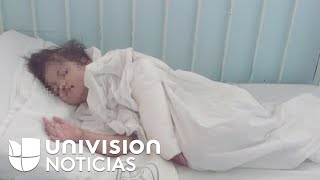 Cada vez más niños mueren por desnutrición extrema en México [upl. by Sellihca]