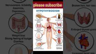 Hyperthyroidism symptoms [upl. by Iliam]