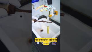 Albumin Test in urine process 👨‍🔬🧪trendingreels viralshort youtubeshorts [upl. by Andaira]