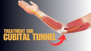 Can You Beat Cubital Tunnel Syndrome Discover Proven Treatment Tipsquot [upl. by Odom745]