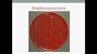 Bacteriology Streptococcus Gram Positive Cocci [upl. by Raffarty221]