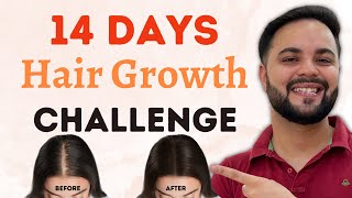 Top 5 Hair Growth Tips  Mens Grooming  Ranveer Allahbadia [upl. by Oterol616]