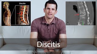 Discitis  everything you need to know [upl. by Yren]