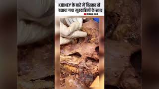 Kidney Explained with Ureter ll Part By Part Define ll Medical dr4u hospital motivation kidney [upl. by Haimarej969]