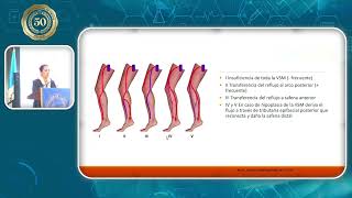 Principios de Eco Doppler Venoso en Insuficiencia Venosa Dra Alejan [upl. by Iztim889]