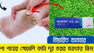 kerasol 6 cream এর কাজ কি  ক্যারাসল ক্রিম এর উপকারীতা  ক্যারাসল ক্রিম ব্যাবহার করার নিয়ম [upl. by Nidnarb]