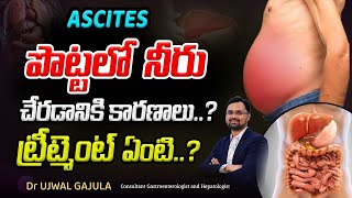 పొట్టలో నీరు చేరడం వల్ల ప్రమాదం ఉందా   Ascites  Dr Ujwal Gajula [upl. by Margarida]