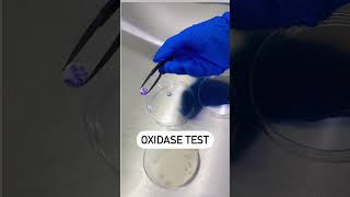 Oxidase Reaction Test  Disc Oxidase Test  Positive Oxidase Reaction microbiology youtubeshorts [upl. by Barthold]