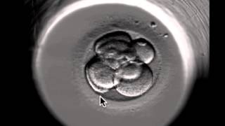 ivf embryo developing over 5 days by fertility Dr Raewyn Teirney [upl. by Ylrebmek]