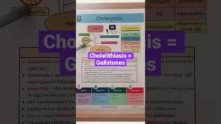 🔥 SIMPLE DIAGRAM  Gallbladder Symptoms amp Pain in 60 SECONDS Gallstones Explained [upl. by Tresa]