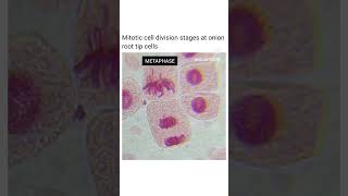 Mitosis in onion root tip in microscope [upl. by Burnley565]