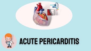 ECG Features of Acute Pericarditis [upl. by Aenat]