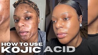 HOW TO USE KOJIC ACID SOAP WATCH THIS BEFORE USING KOJIC ACID [upl. by Avonasac]