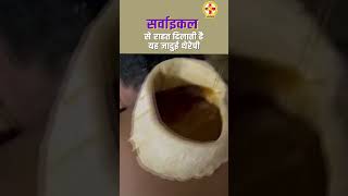 How to Treat Cervical Spondylosis Naturally  Greeva Vasti Benefits  Panchakarma for Neck pain [upl. by Ahcsap938]