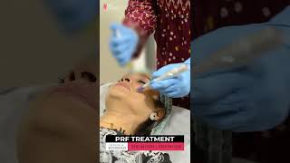 PRF Treatement For Dull Skin Issue  HASH CLINICS [upl. by Akimet]