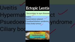 Causes for ECTOPIA LENTIS Ophthalmology shorts 3 mark question Optometry [upl. by Perkins]