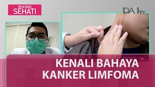 Kenali Bahaya Kanker Limfoma  Bincang Sehati Part 2 [upl. by Inilam]