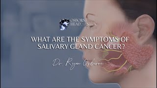 What are the symptoms of salivary gland cancer [upl. by Alaric]