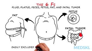 Abdominal Distension The 6 Fs that can help your diagnosis [upl. by Zaragoza613]