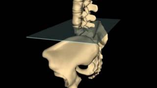 Posterior Innominate Rotation [upl. by Balcke]