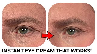 THE INSTANT EYE CREAM THAT WORKS IMMEDIATELY [upl. by Aloek141]