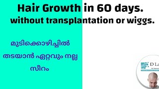 മുടികൊഴിച്ചിൽ നിക്കാൻ ഏറ്റവും നല്ല സീറം hairloss hairfall hairfallsolution baldnesssolution [upl. by Raveaux]