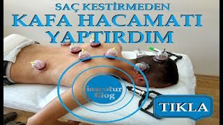 ⭐️Saç Kesmeden Kafa Hacamatı Yaptırdım ✅Kafa Hacamatı Nasıl Yapılır [upl. by Ymerrej323]