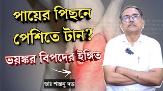 পায়ের পিছনে পেশিতে ব্যথা ভয়ঙ্কর বিপদের ইঙ্গিত কি  মাংসপেশির ব্যথার কারণ  Muscle Pain cause [upl. by Ahcilef826]