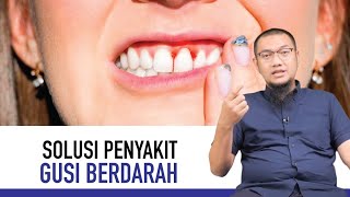 Gusi Berdarah Gejala Peyebab dan Cara Mengatasi │ Kata Dokter [upl. by Rouvin]