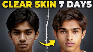 7 రోజుల్లో Clear Skin  10x Glow ✨ Tips for Naturally Glowing Skin and Home Remedies [upl. by Dilks]