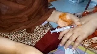 iv injection videoKetorolac iv injection push Ketonic 30 24 Ep34 Anik Injection Tips [upl. by Rehteh]