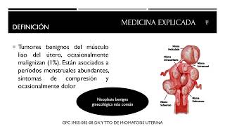 Miomatosis para el ENARM [upl. by Stockmon]