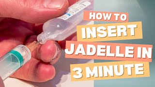 How to insert Jadelle implant in 3 minutesthe easiest way to insert Jadelle implantfamily planning [upl. by Asiole]