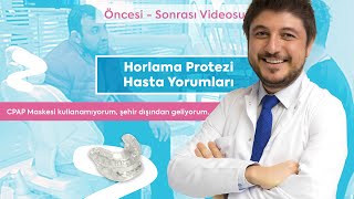 Horlama Protezi Kullanan Hastamızın Öncesi ve Sonrası Yorumları [upl. by Perrie]