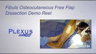 Fibula Osteocutaneous Free Flap Dissection Video [upl. by Otanod]