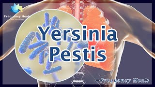 Relieve Yersinia Pestis  Energy amp Quantum Medicine  Healing Frequency  Raise Vibrations [upl. by Tena]