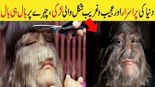 Worlds Hairiest Girl Supatra Sad And Inspiring Story In Urdu Hindi [upl. by Gnad]