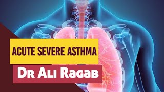 icu chest 5 Acute Severe Asthma [upl. by Lienad]