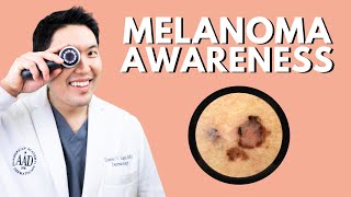 Melanoma Awareness Info from a Board Certified Dermatologist [upl. by Silvers921]