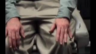 22 Parkinsonian Rest Postural and Reemergent Tremor  Tremors Spring Video Atlas [upl. by Anayit]