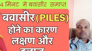 Piles Homeopathic Treatment Bawasir ka Homeopathic medicine बवासीर का इलाज [upl. by Mmada]